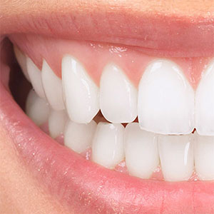 Отбеливание зубов в стоматологической клинике у др. Сабо Яноша